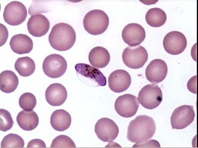 plasmodium-falciparum