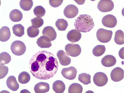 трехдневная-малярия